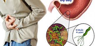 XÉT NGHIỆM VI KHUẨN HP (Helicobacter pylori) ???