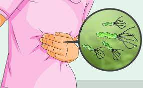 NHIỄM KHUẨN H.P (HELICOBACTER PYLORI): TRIỆU CHỨNG VÀ CÁCH ĐIỀU TRỊ