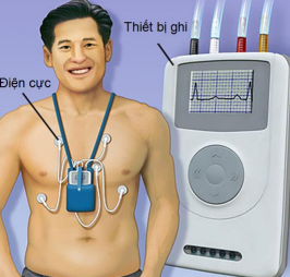 ĐO HOLTER ĐIỆN TIM LÀ GÌ?  KHI NÀO CẦN ĐO?