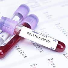 Beta 2 microglobulin