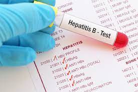 Định lượng HBV-DNA