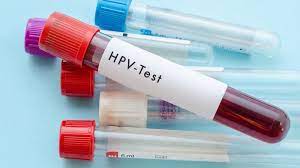 PCR HPV