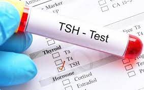 TSH