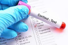 Cortisol (máu/ nước tiểu 24h)