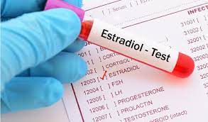 Estradiol (E2)