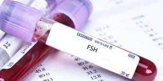 FSH