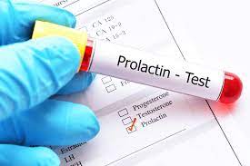 Prolactin