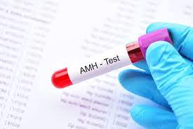 AMH (Anti-Mullerian Hormon)