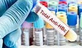 Anti - HBc (IgM + IgG)