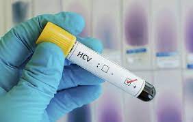 Anti - HCV