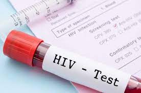 Anti - HIV