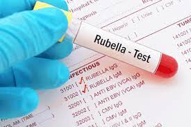 Rubella (IgM + IgG)