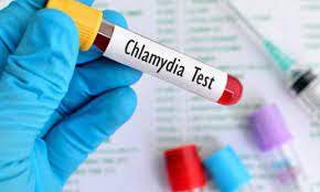 Chlamydia (IgM + IgG)