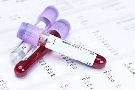 EBV (IgM + IgG)
