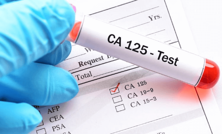 CA125