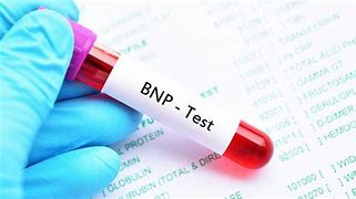 NT-proBNP