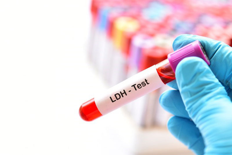 Lactate Dehydrogenase (LDH)
