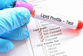 Bilan lipid (Mỡ máu)