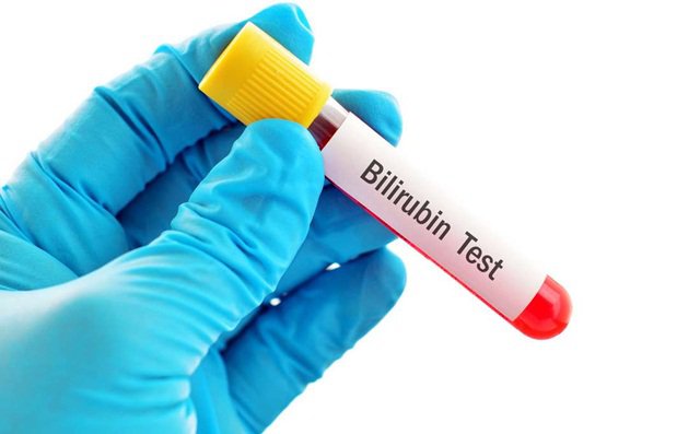 Bilirubin (TP,TT,GT)