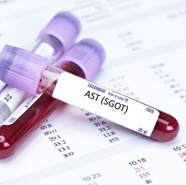 AST (GOT)